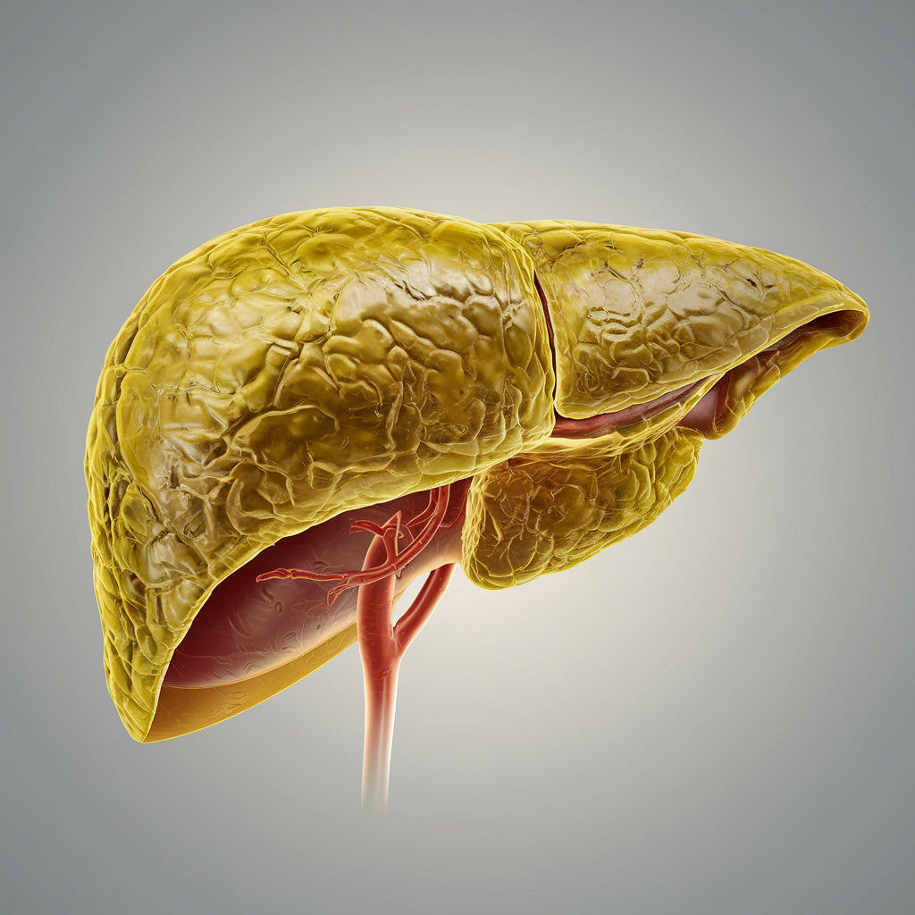 Esteatose Hepática: Como Combater a Gordura no Fígado de Forma Natural e Eficaz