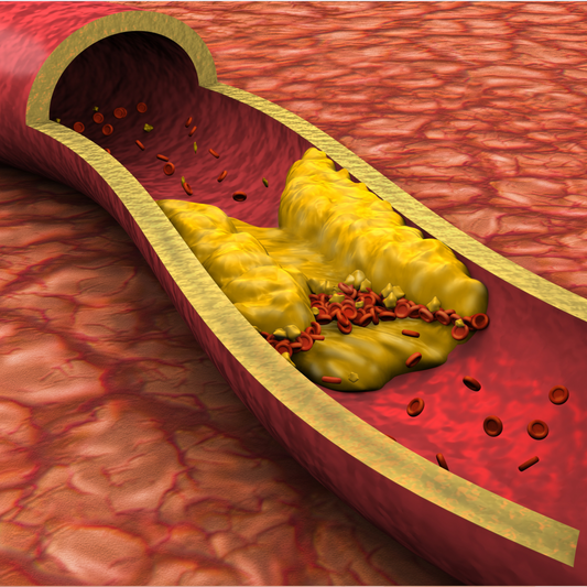 Colesterol Alto: Como Regular de Forma Natural e Eficaz